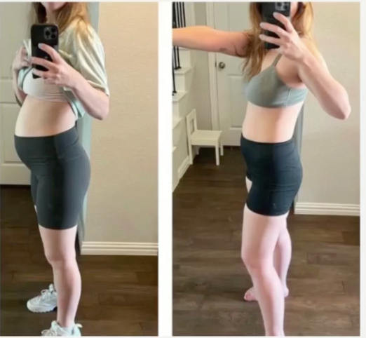 Melanie's bloating transformation, before and after meals.